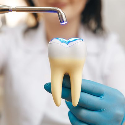 a dentist demonstrating how a dental filling is placed